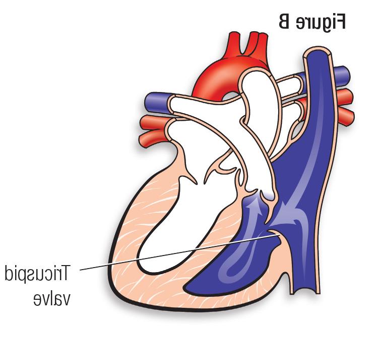 Normal heart figure B