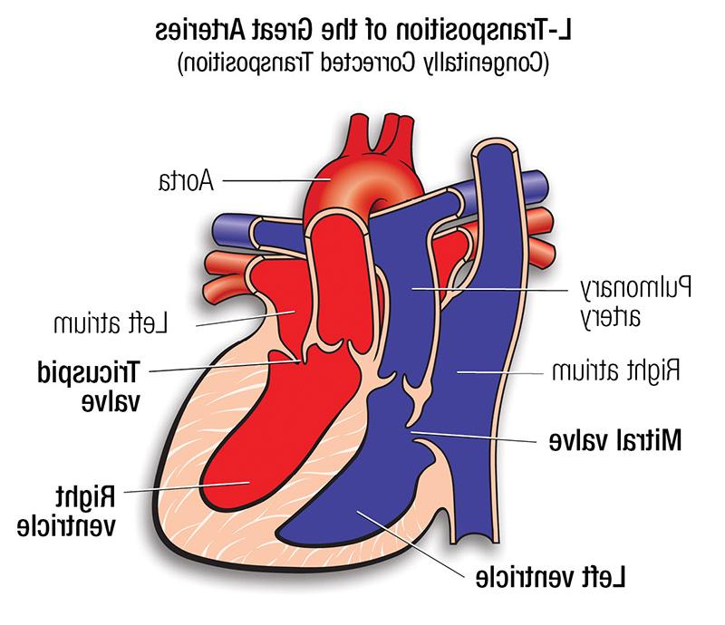 L-TGA diagram